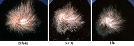 �v���y�V�A1�N���^��