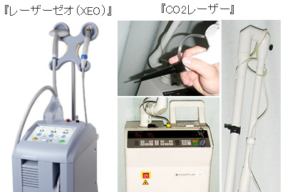 XEO(�[�I)��CO2���[�U�[