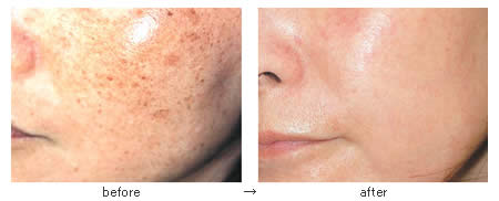 ���΂���