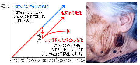 ����̗\�h�ƘV���ɂ���