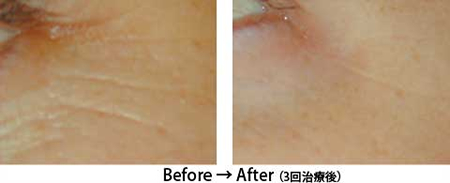 ���[�U�[�ł̂�����