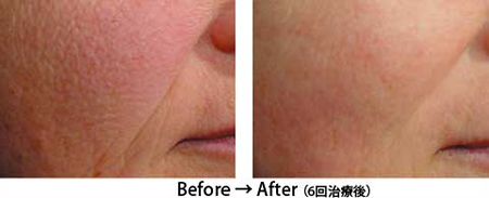 ���[�U�[�ł���ݎ���