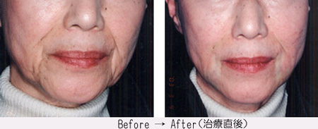 �q�A�������_�����ł�����E����ݎ���