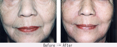 �{�b�g�N�X���˂ŃV�����E����ݎ���